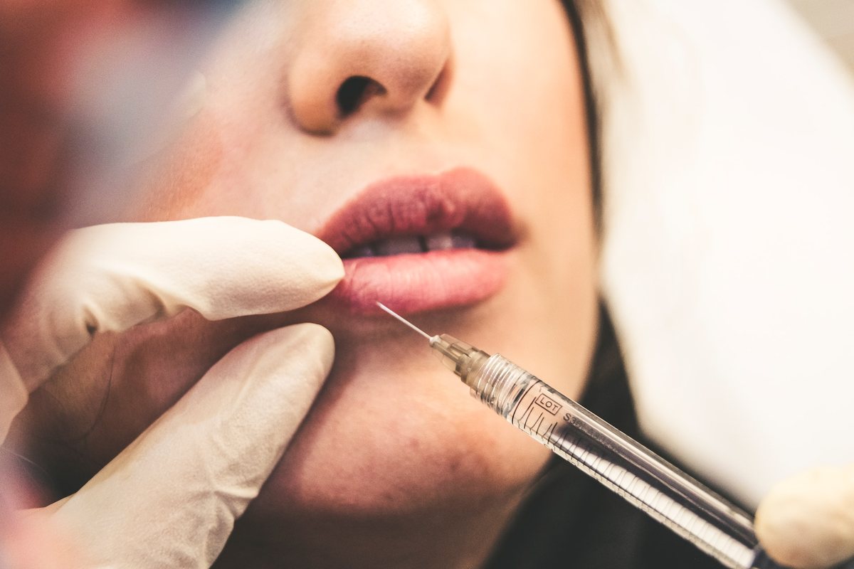 A dermal filler being administered by a clinician